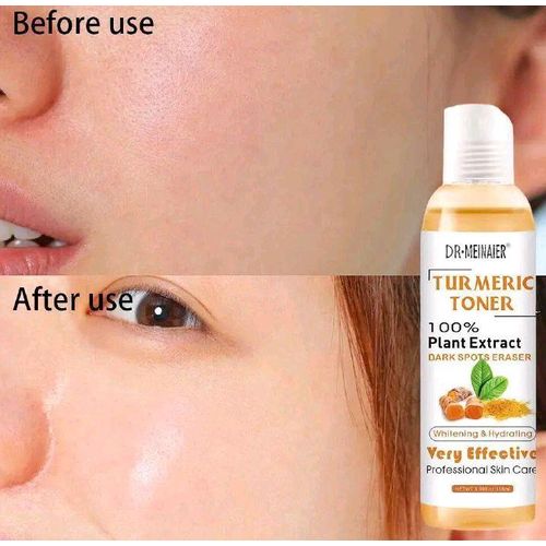 DR MEINAIER 2 Pcs : Tumeric Toner 100% Plant Extract Dark Spots Eraser