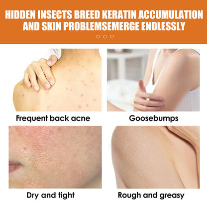 50g Turmeric Scrub for Face and Body Skin Rejuvenating Anti A-cne Brighten Skin Tone Soften Skin Exfoliating Face Care Scrub