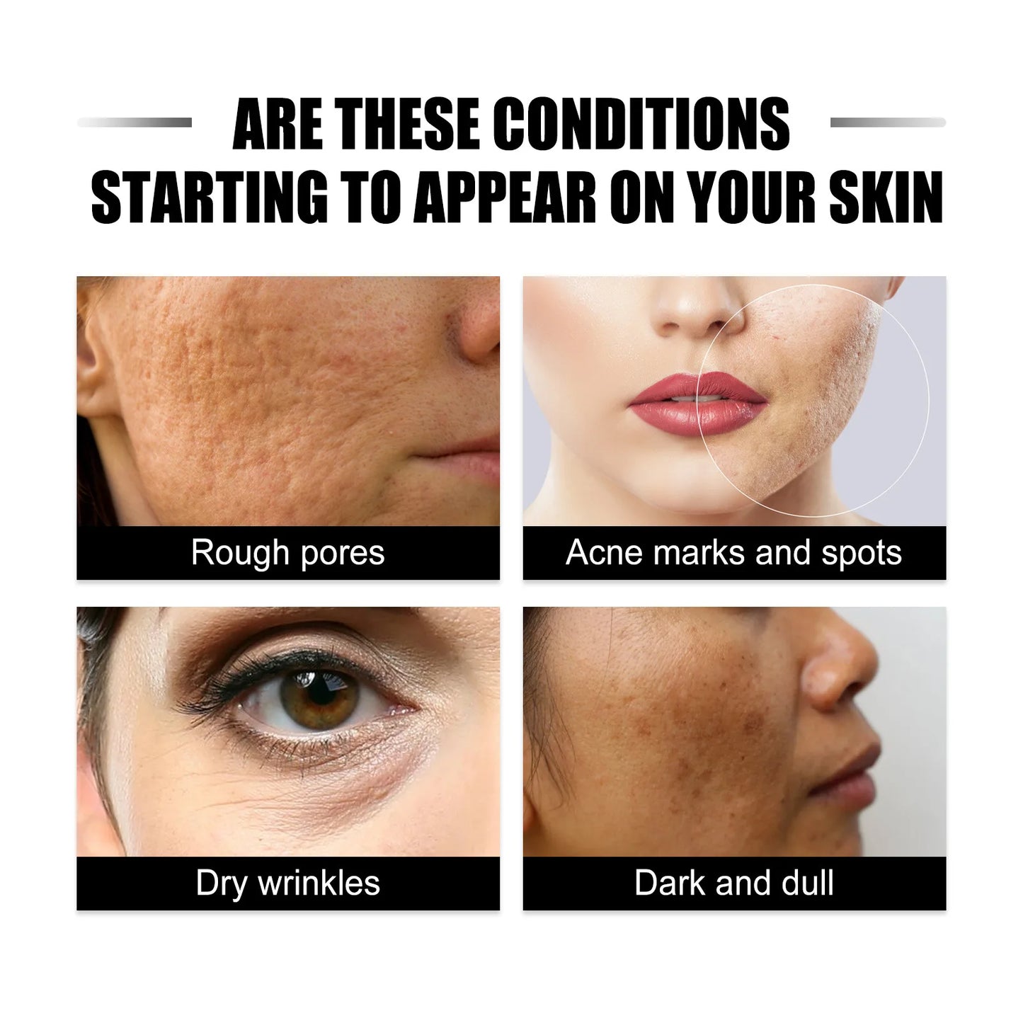 Reduce Dullness Serum Anti Wrinkles Age Brighten Whiten Nourish Repairing Remove Acne Shrink Rough Pores Fade Fine Lines Essence