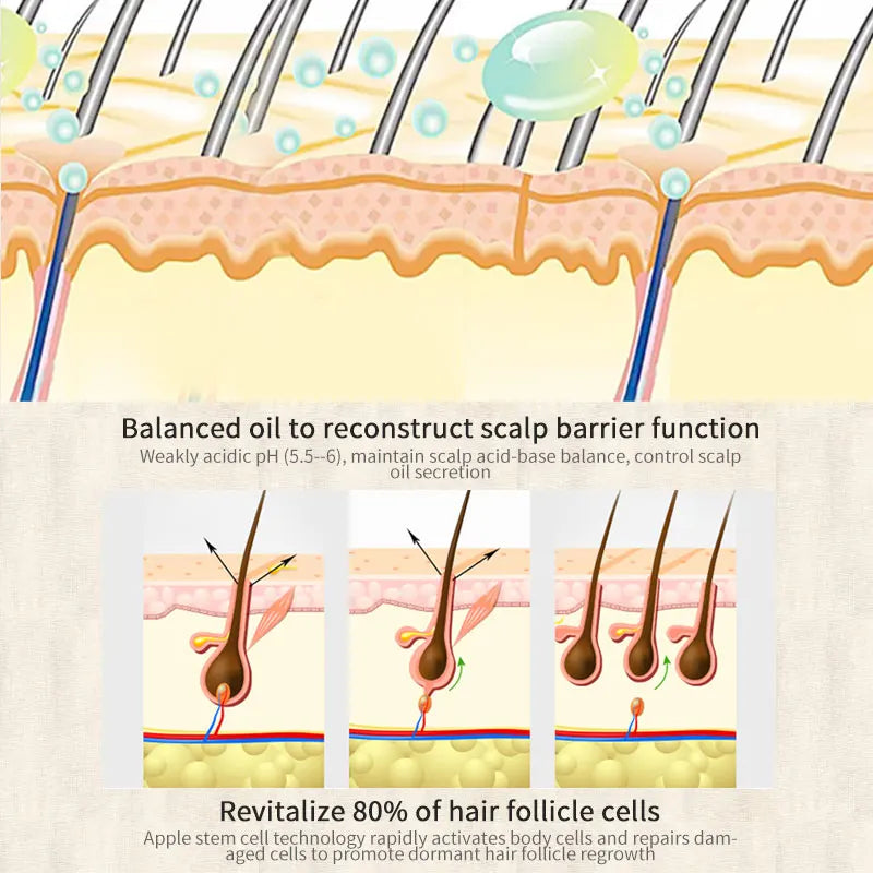 Sevich 30ml Herbal & Ginger Hair Growth Essence Spray  Help For Hair Loss Treatment Fast growth Hair Spray Anti-Hair Loss