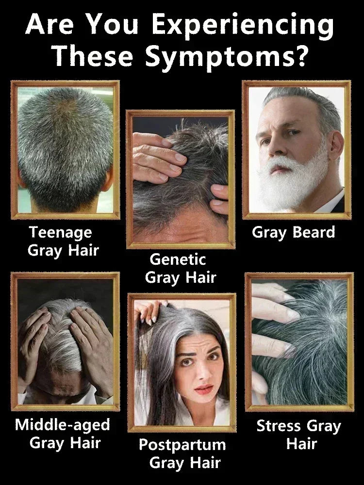 Natural Anti Gray Hair Serum | Nourishing Hair Care Remedy - Repair White & Darkening Hair