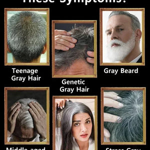 Natural Anti Gray Hair Serum | Nourishing Hair Care Remedy - Repair White & Darkening Hair