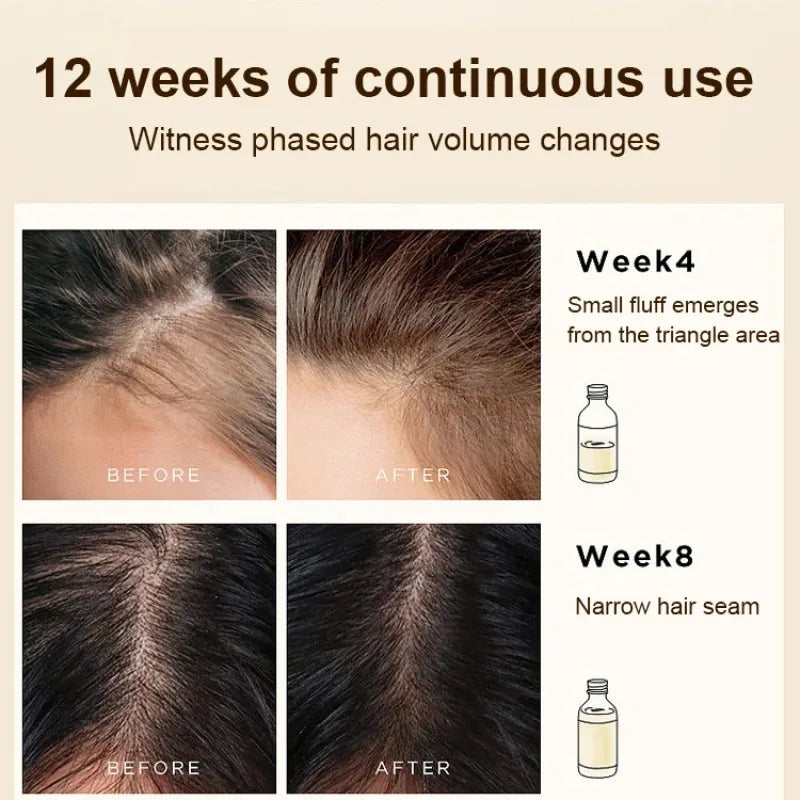 Anti-Hair Loss Roller Massage Hair Growth Serum Improve Hair Lose Care Biotin Herbal Serum Growth Nourishing Soothing Scalp Seru