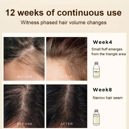 Anti-Hair Loss Roller Massage Hair Growth Serum Improve Hair Lose Care Biotin Herbal Serum Growth Nourishing Soothing Scalp Seru