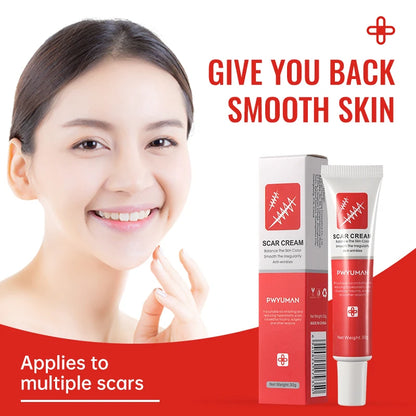Fast Scar Removal Cream Treatment Stretch Marks Burn Surgical Scar Acne Spots Repair Gel Whitening Moisturizing Smooth Skin Care