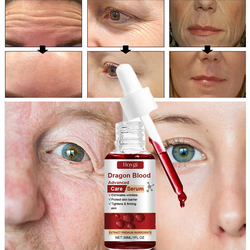 Dragon Blood Advanced Serum Effective Resist Aging Tighten Skin Reduce Wrinkles Brighten Skin Tone Improve Dullness Face Essence