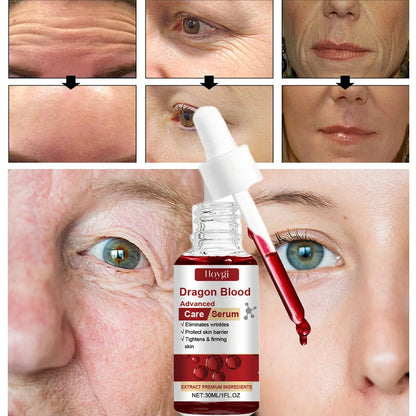 Dragon Blood Advanced Serum Effective Resist Aging Tighten Skin Reduce Wrinkles Brighten Skin Tone Improve Dullness Face Essence