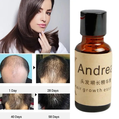 20ml Herbal Keratin Fast Hair Growth Oil Andrea Alopecia Loss Liquid Ginger Sunburst Yuda Pilatory Oil Hair Growth Serum Oil