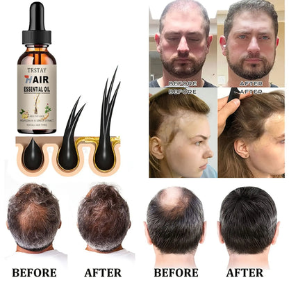 New Rosemary Oil for Beard Ginger Hair Growth Oil for Men Essence Hair Nutrient Conditioner Care Essential Oil for Black Women