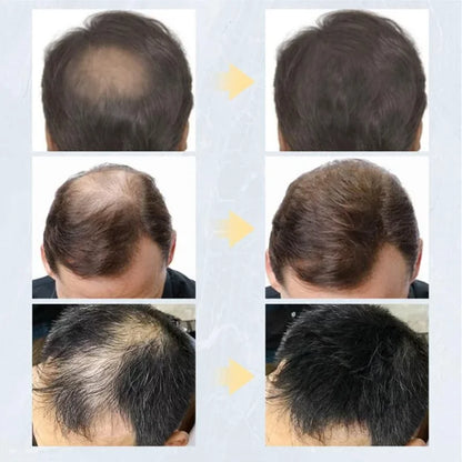 3pcs 27.5g Hair Building Fiber Natural Keratin Styling Powder Loss Bald Fibre Pack Building Hairline Optimizer Dense Hair Growth