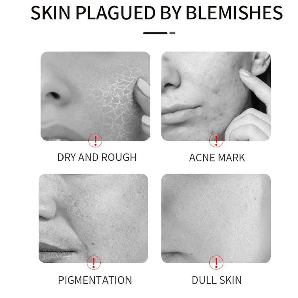 VICHY 16%VC brightening essence & HA moisturizing hyaluronic acid essence brightening, firming, improving dullness Facial Serum