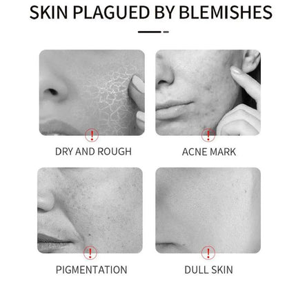 VICHY 16%VC brightening essence & HA moisturizing hyaluronic acid essence brightening, firming, improving dullness Facial Serum