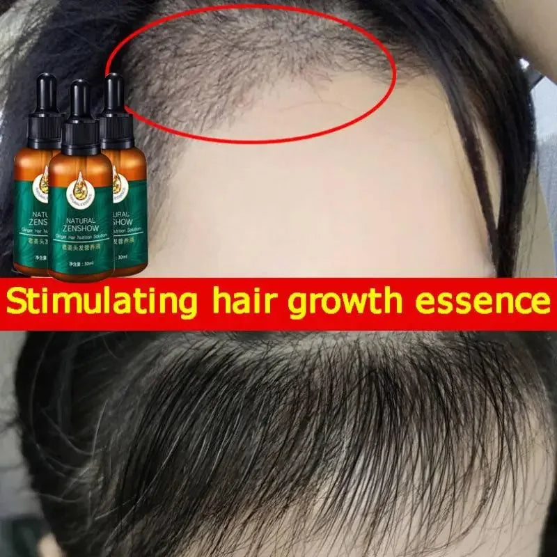Ginger Hair Growth Essential Oil Herbal Hair Care Anti-Hair Loss Repair Hair Follicles Stimulate Hair Growth