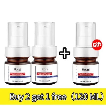 Powerful Dark Spots Remover Whiten Serum Cream Vitamin C Skin Brighten Serum Removal Melasma Dark Spots Repair Beauty Skin Care