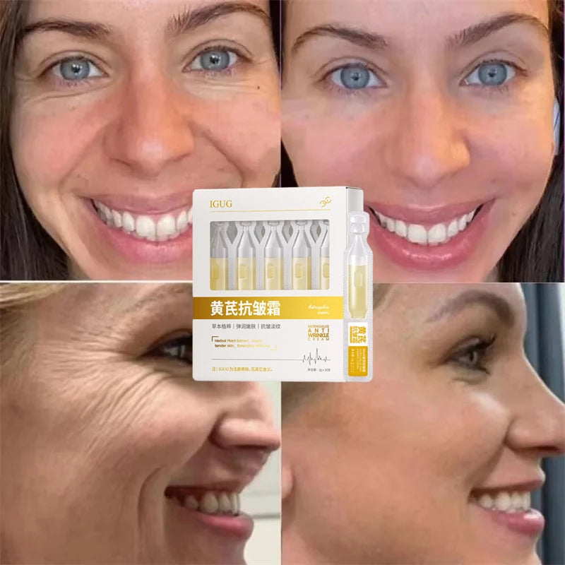 Astragalus Instant Wrinkle Remover Essence Fade Fine Lines Face Serum Anti Aging Firming Lifting Whitening Korean Skin Care