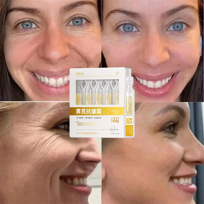 Astragalus Instant Wrinkle Remover Essence Fade Fine Lines Face Serum Anti Aging Firming Lifting Whitening Korean Skin Care