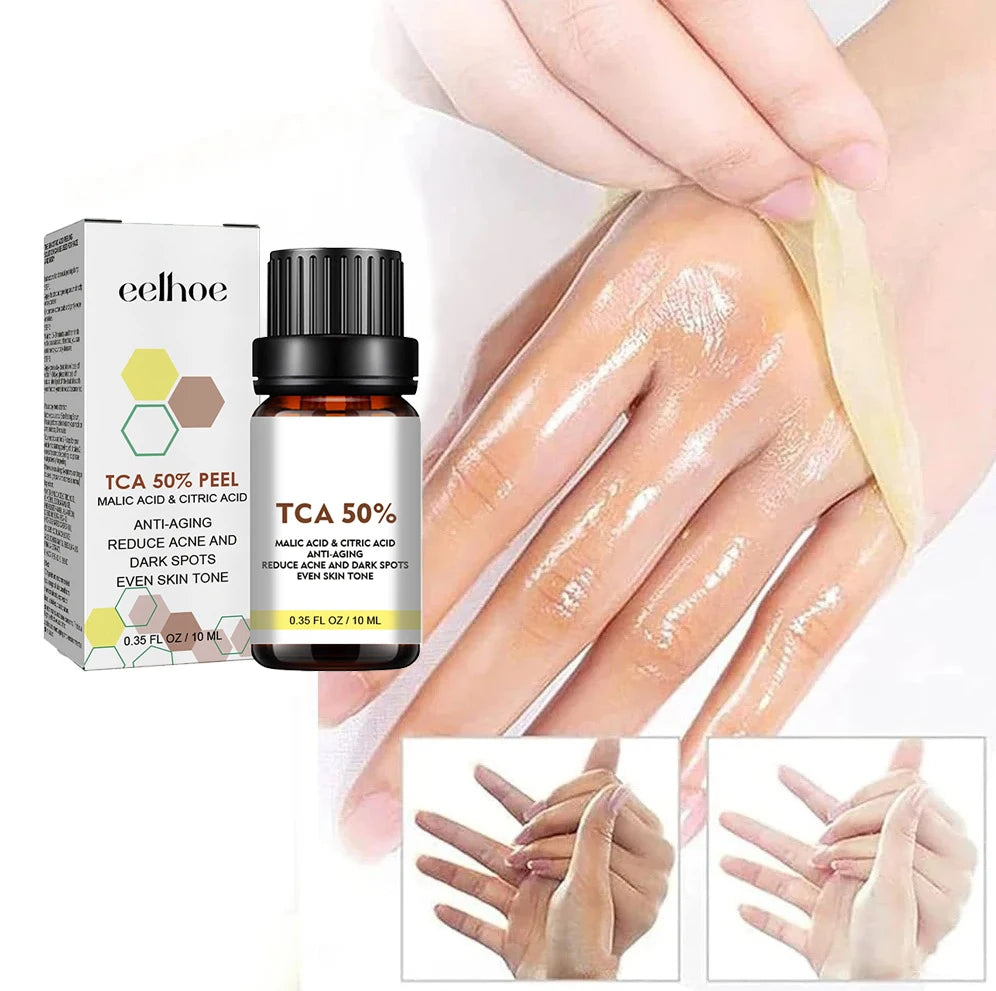 With Malic Acid And Citric Acid For Face  Facial Peel 40% Peeling Serum Peeling Serum Chemical Peel