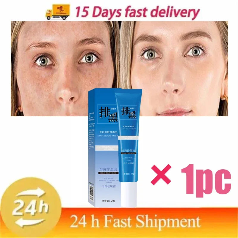 Dark Spots Removal Cream Facial Whitening Freckle Acne Mark Pigmentation Removal Melanin Skin Correction Brighten Care Products