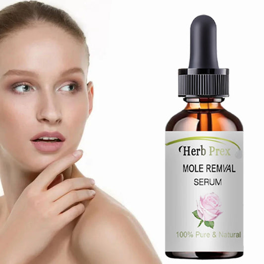 5ML/15ML/30ML/50ML/Spot removing cream, removing and spot whitening cream, moisturizing and caring for the skin