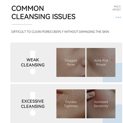 Deep Cleansing Facial Foam Gel - Oil Control Acne Mark Removal Pore Refining Blackhead Eliminator Face Wash for Clearer Skin