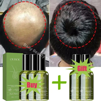 Fast Hair Growth Serum Spray Anti Hair Loss Prevent Baldness Scalp Treatment Repair Roots Beauty Health Hair Care For Men Women