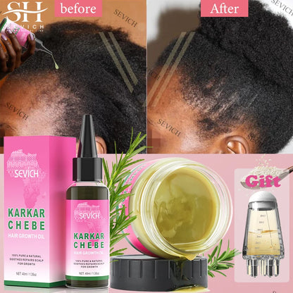 2024 New Super Growth Oil Karkar Regrowth Thicken Oils Chebe Anti-Breakage Essential Oil Serum Rosemary Anti Hair Loss Products
