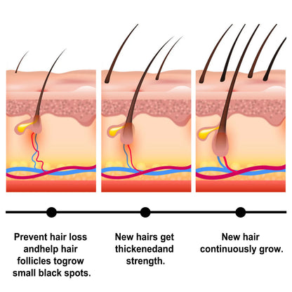 Hair Growth Serum Batana Oil Hair Thinning Dry Frizzy Baldness Repair Scalp Treatment Liquid Anti Hair Loss Regrowth Essence