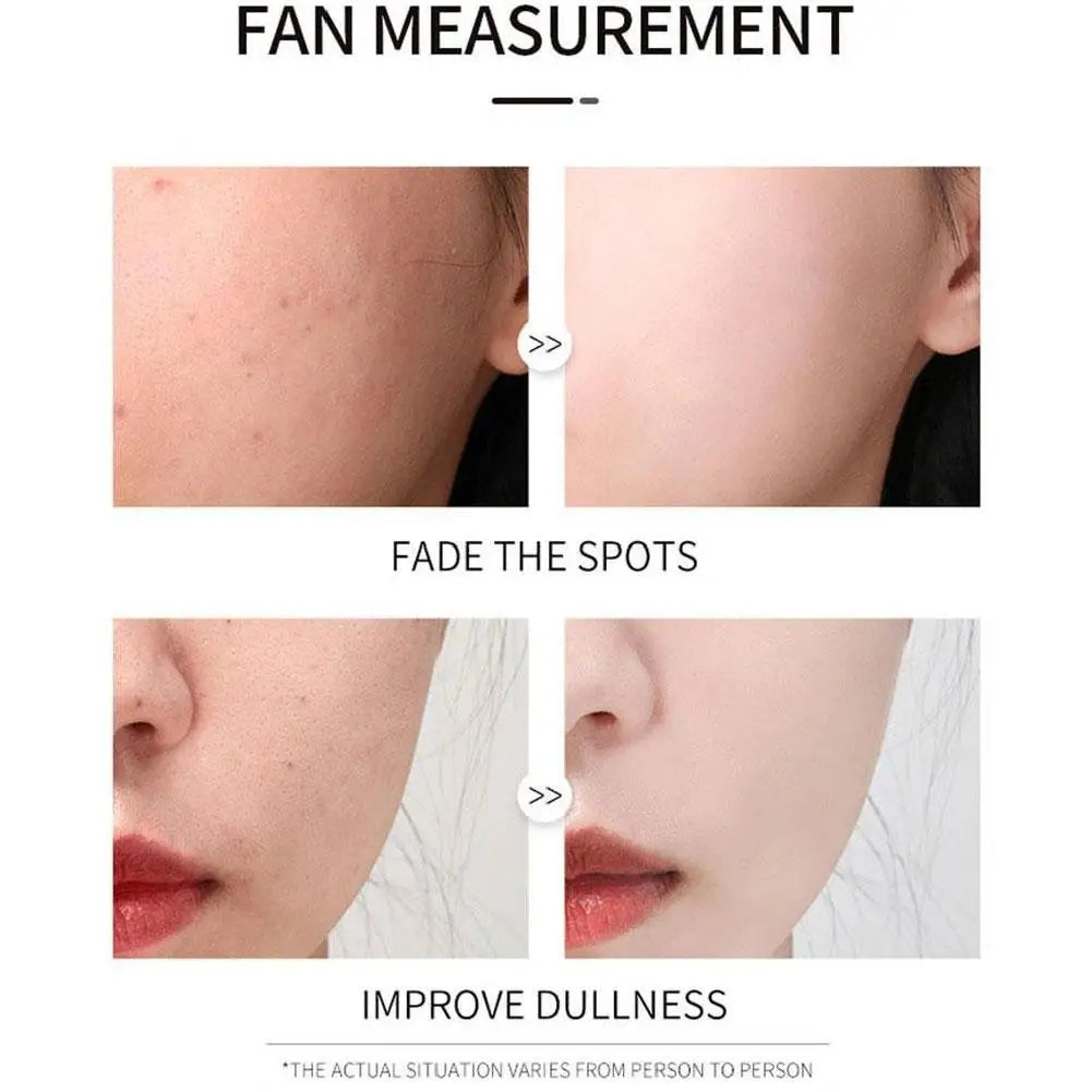 VICHY 16%VC brightening essence & HA moisturizing hyaluronic acid essence brightening, firming, improving dullness Facial Serum