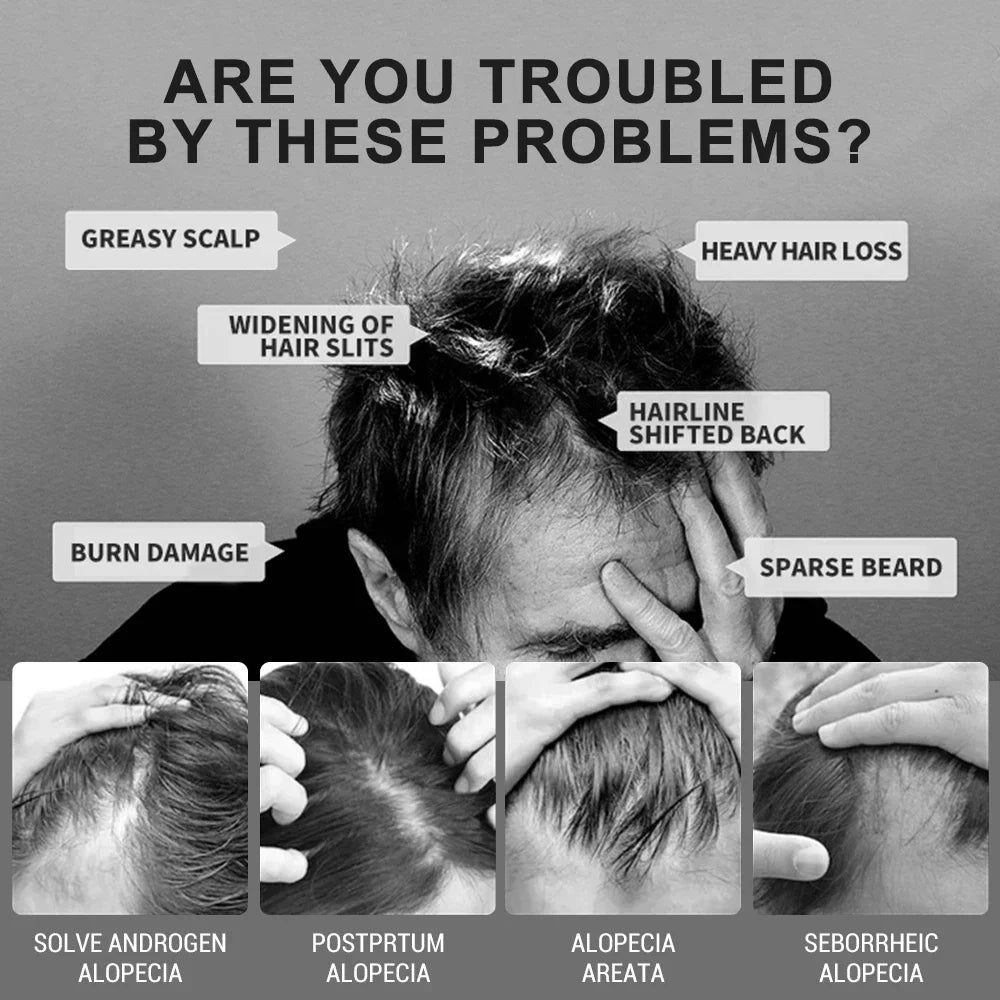 Beard Growth Serum Spray Hair Growing Essential Oil Fast Styling Thicker Longer Fuller Beard Softening Moisturizing Beard Liquid