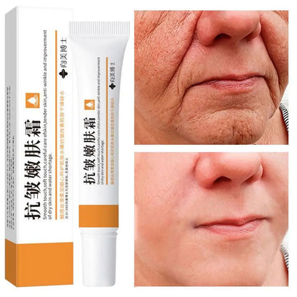 20g Retinol Facial Cream Remove Dark Spot Cream Anti Freckle Aging Fade Pigmentation Melasma Brighten Serum Skin Care