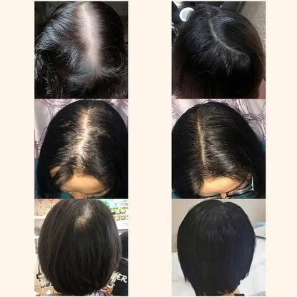 Ginger Hair Growth Essential Oil Herbal Hair Care Anti-Hair Loss Repair Hair Follicles Stimulate Hair Growth