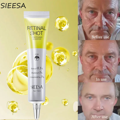 Retinol Anti-wrinkle Cream Collagen Anti-Aging Instant Removal Face Neck Wrinkle Efficient Moisturizing Firming Korean Skin Care
