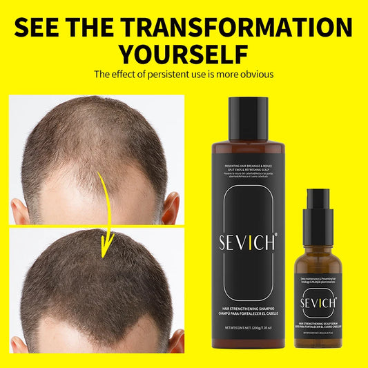 Shampoo Reduce Hair Loss Stabilize Hair Roots Nourishing Anti-loss Hair Hair Growth Oil Hair Strengthens Restore Damaged Shampoo