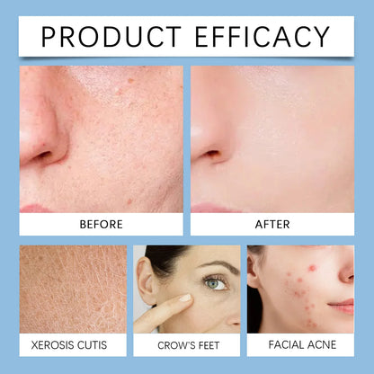 Hoygi Salicylic Acid Exfoliating Pads for Face 70pcs Gentle Skin Brightening Toner Wipes with Glycolic Acid for Smooth Texture