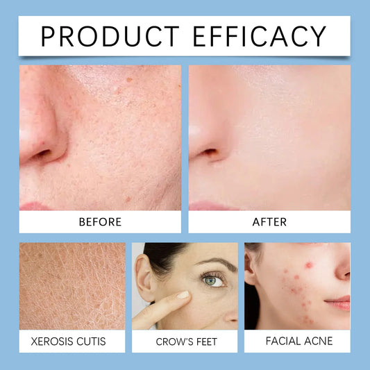 Hoygi Salicylic Acid Exfoliating Pads for Face 70pcs Gentle Skin Brightening Toner Wipes with Glycolic Acid for Smooth Texture