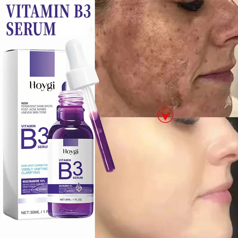 Hoygi Niacinamide Facial Serum Vitamin B3 Wrinkles Pigment Dark Spot Removal Correcting Glow Serum Face Whitening Moisturizer