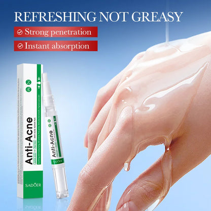 Salicylic Acid Acne Treatment Face Serum Repair Pimple Spots Deep Cleaning Pore Anti-acne Scar Oil Control Moisturizer Skin Care