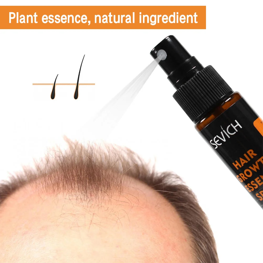Powerful Hair Growth Essence Spray Natural Ginger ingredient Nourish Root Prevent Hair Loss Scalp Treatment Improve Alopecia oil