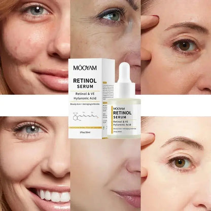 Retinol Facial Essence 2.5% with Hyaluronic Acid VE Anti-Aging Serum for Smooth Skin And Acne Treatment face Reduces Wrinkles