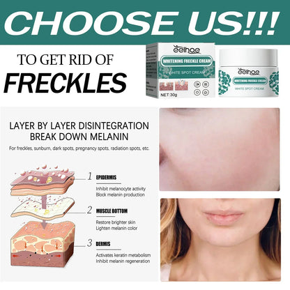 Removal Dark Spots Whitening Freckle Cream Leaving skin looking brighter clearer and more luminous prevent future discoloration