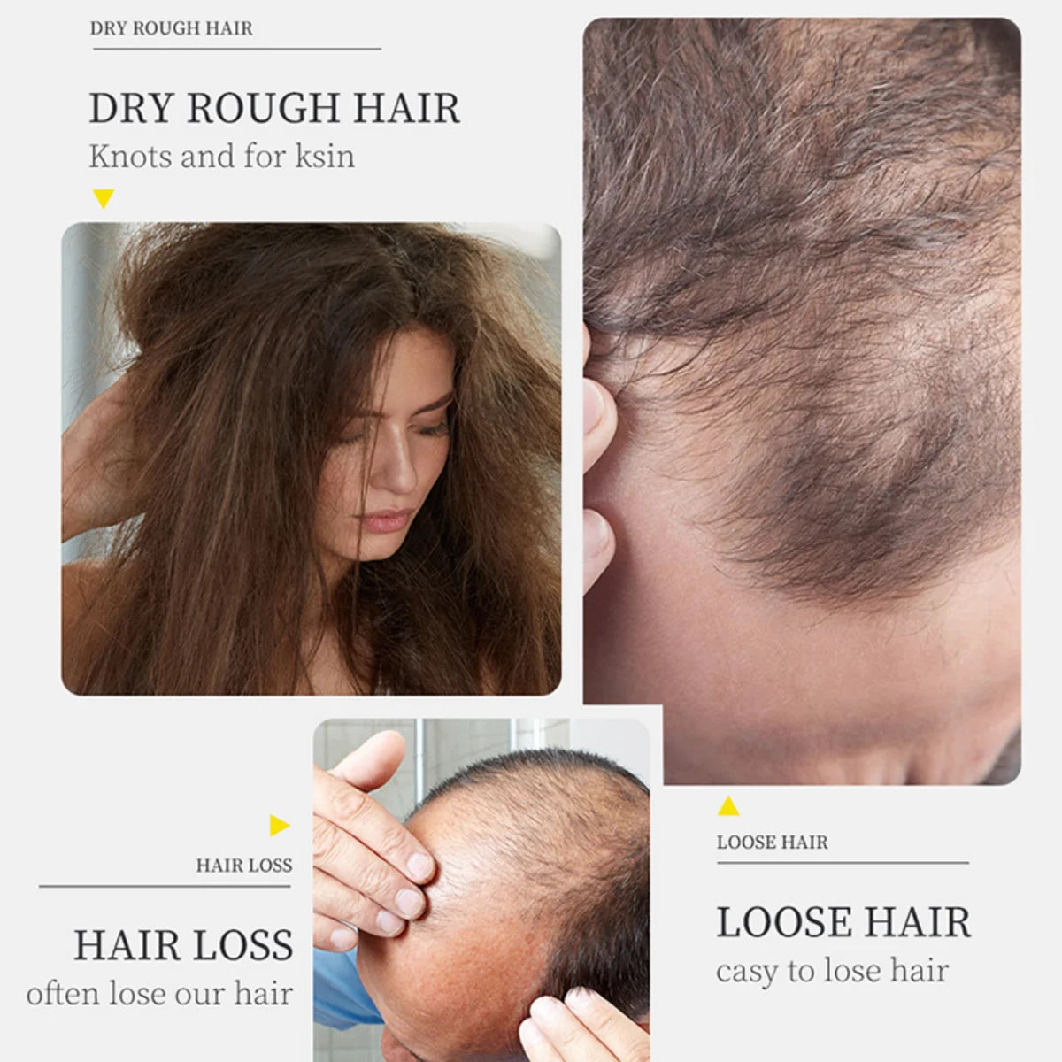 Hair Care Oil Hair Roots Scalp Treatment Improve Androgenetic Alopecia Scalp Treatment Serum Strengthen Hair Roots