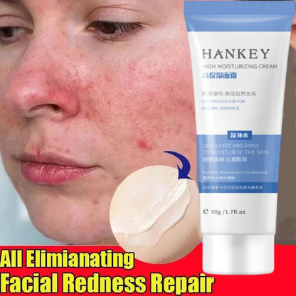 Facial Redness Repair Cream Improve Sensitive Skin Moisturizer Hydrate Sooth Lotion Removal Rosacea Spider Vein Korean Cosmetic