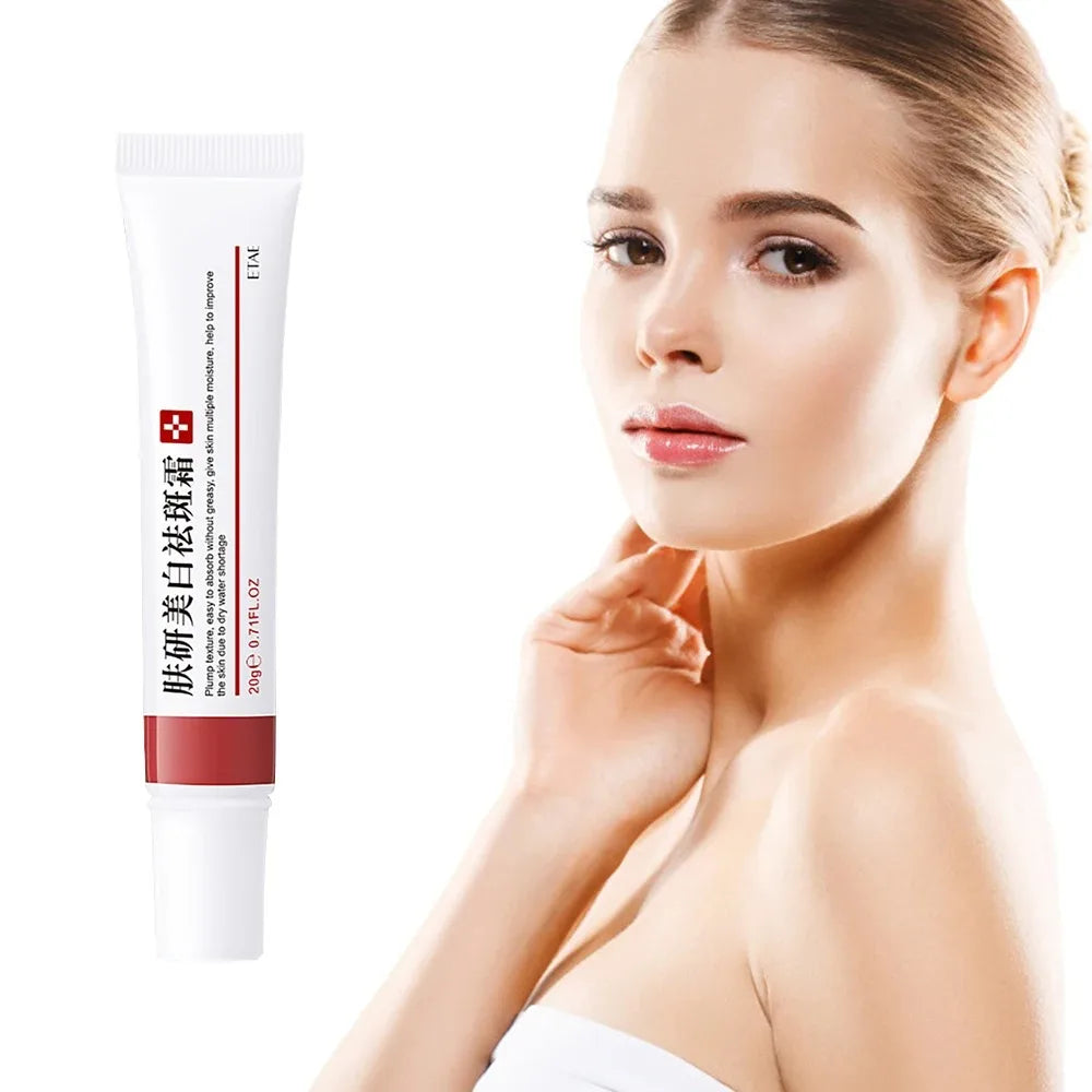 Powerful Whiten Freckle Cream Brighten Face Eliminates Dark Face Spot Melasma Melanin Pigmentation Moisturize Skin Care Cream