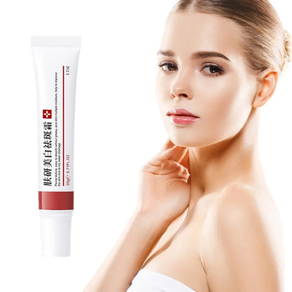 Powerful Whiten Freckle Cream Brighten Face Eliminates Dark Face Spot Melasma Melanin Pigmentation Moisturize Skin Care Cream