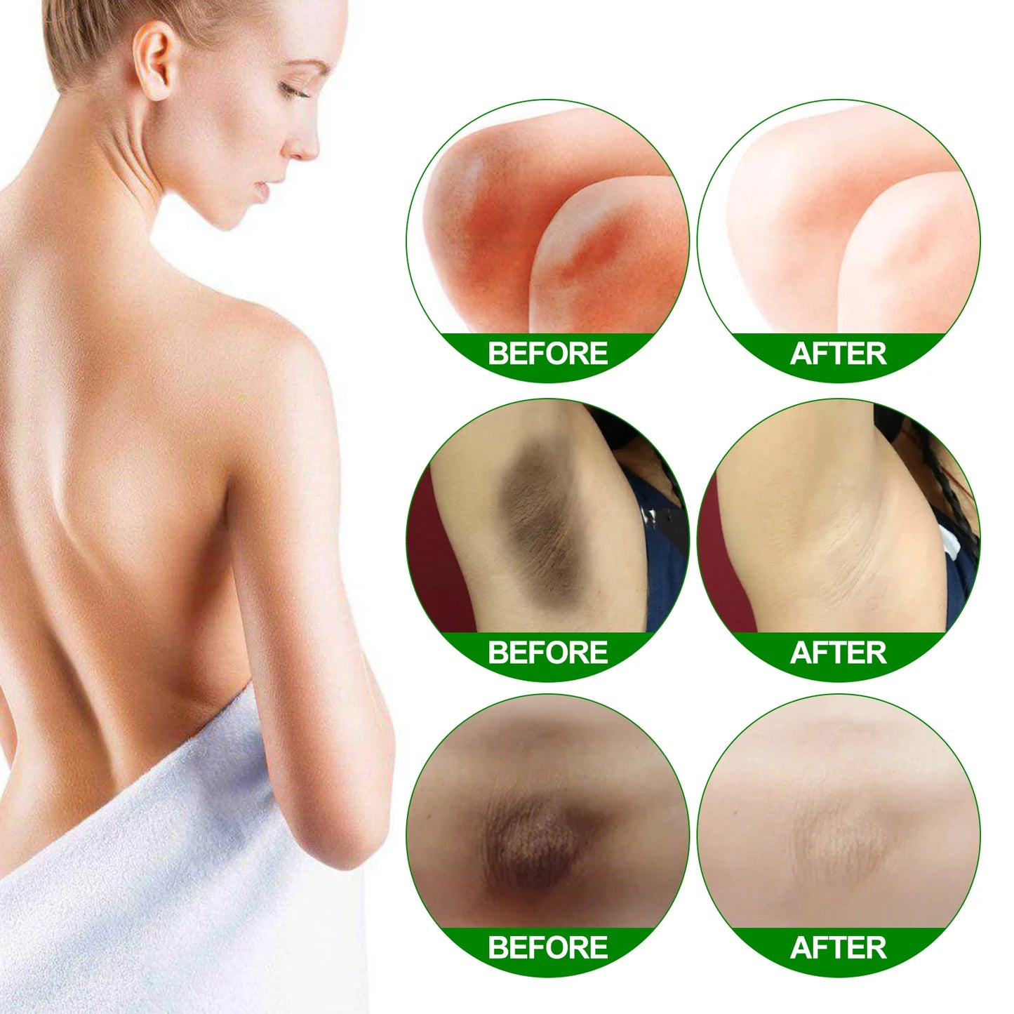 Retinol Whitening Cream for Dark Skin Knee Buttocks Underarm Butt Inner Brightening Private Part Remove Melanin Bleaching Cream