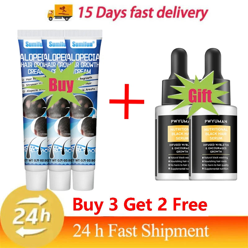 7 days Fast Hair Growth Cream Anti Hair loss Prevent Baldness Scalp Treatment Repair Roots Beauty Health Hair Care For Men Women