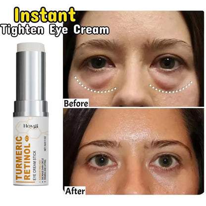 Instant Eye Bag Remove Eye Cream Anti Fat Particles Dark Circles Puffiness Fade Fine Lines Lift Brighten Korean Beauty Eye Care