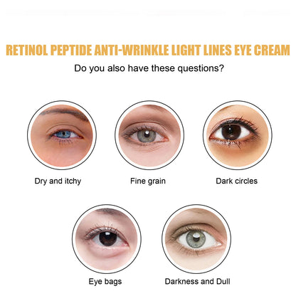 Retinol Peptide Eye Cream Reduce Dark Circles Eye Bag Remover Improve Puffiness Fade Eyes Fine Lines Brighten Eye Cream