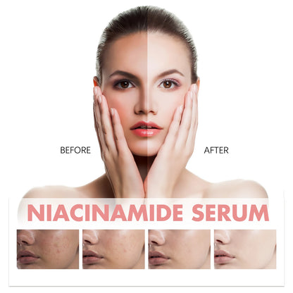 Niacinamide Facial Serum Fade Melanin Moisturzing Rejuvenation Shrink Pores Smooth Brightening Skin Care Dark Spot Remover Serum