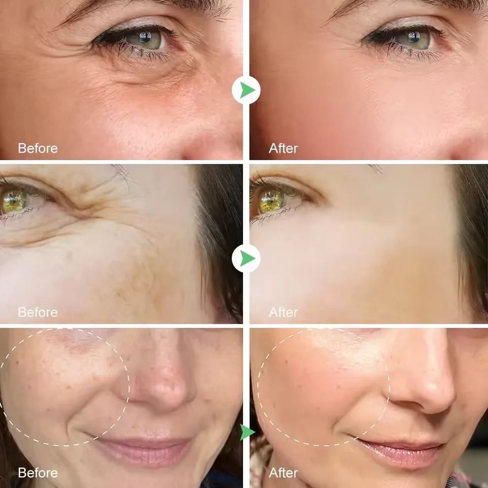 Retinol Remove Wrinkle Face Serum Lift Firming Anti Aging Fade Fine Lines Whitening Brightening Moisturizer Skin Care Cosmetics